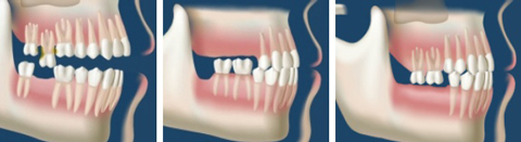 gnatologia odontoiatria cuneo