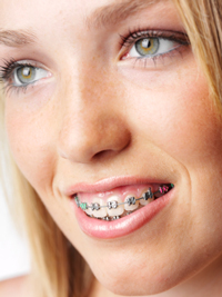 ortodonzia dentale cuneo