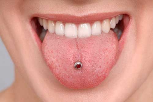 Piercing orali e denti